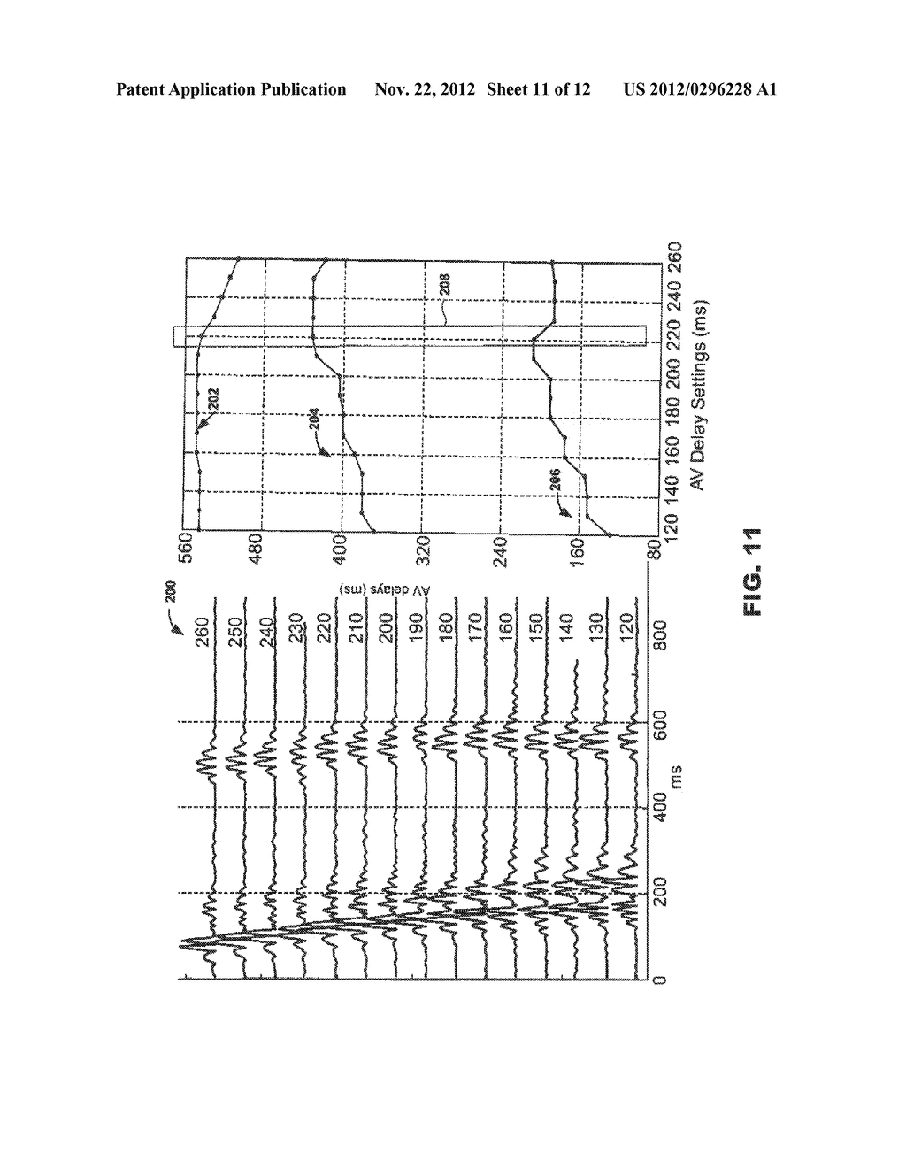 HEART SOUNDS-BASED PACING OPTIMIZATION - diagram, schematic, and image 12