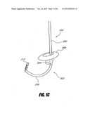 METHODS AND DEVICES FOR INTRAGASTRIC SUPPORT OF FUNCTIONAL OR PROSTHETIC     GASTROINTESTINAL DEVICES diagram and image