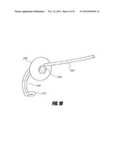 METHODS AND DEVICES FOR INTRAGASTRIC SUPPORT OF FUNCTIONAL OR PROSTHETIC     GASTROINTESTINAL DEVICES diagram and image