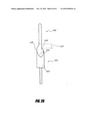 METHODS AND DEVICES FOR INTRAGASTRIC SUPPORT OF FUNCTIONAL OR PROSTHETIC     GASTROINTESTINAL DEVICES diagram and image