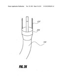 METHODS AND DEVICES FOR INTRAGASTRIC SUPPORT OF FUNCTIONAL OR PROSTHETIC     GASTROINTESTINAL DEVICES diagram and image