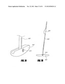 METHODS AND DEVICES FOR INTRAGASTRIC SUPPORT OF FUNCTIONAL OR PROSTHETIC     GASTROINTESTINAL DEVICES diagram and image