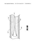 METHODS AND DEVICES FOR INTRAGASTRIC SUPPORT OF FUNCTIONAL OR PROSTHETIC     GASTROINTESTINAL DEVICES diagram and image