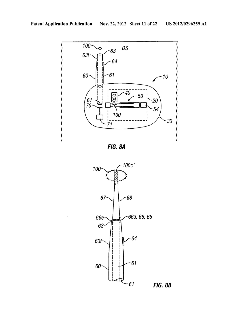 SOLID DRUG DELIVERY APPARATUS AND FORMULATIONS AND METHODS OF USE - diagram, schematic, and image 12