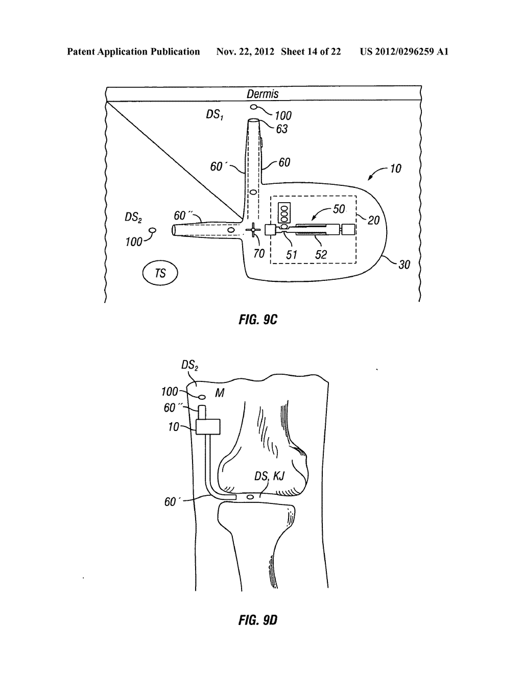 SOLID DRUG DELIVERY APPARATUS AND FORMULATIONS AND METHODS OF USE - diagram, schematic, and image 15