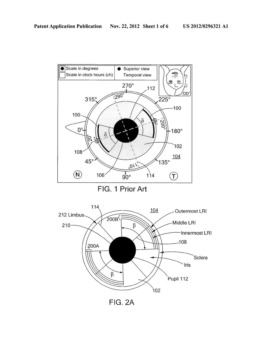 SYSTEM AND METHOD FOR CORRECTING ASTIGMATISM USING MULTIPLE PAIRED ARCUATE     LASER GENERATED CORNEAL INCISIONS - diagram, schematic, and image 02