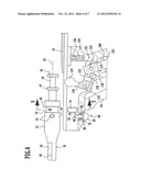 SURGICAL INSTRUMENT diagram and image