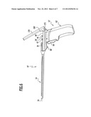 SURGICAL INSTRUMENT diagram and image