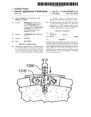 JOINT ARTHROPLASTY DEVICES AND SURGICAL TOOLS diagram and image