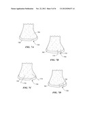 JOINT ARTHROPLASTY DEVICES AND SURGICAL TOOLS diagram and image