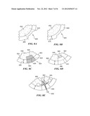 JOINT ARTHROPLASTY DEVICES AND SURGICAL TOOLS diagram and image