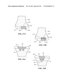 JOINT ARTHROPLASTY DEVICES AND SURGICAL TOOLS diagram and image