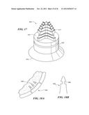 JOINT ARTHROPLASTY DEVICES AND SURGICAL TOOLS diagram and image