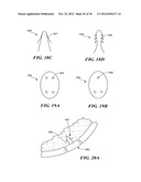 JOINT ARTHROPLASTY DEVICES AND SURGICAL TOOLS diagram and image