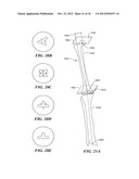 JOINT ARTHROPLASTY DEVICES AND SURGICAL TOOLS diagram and image