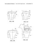 JOINT ARTHROPLASTY DEVICES AND SURGICAL TOOLS diagram and image