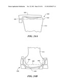 JOINT ARTHROPLASTY DEVICES AND SURGICAL TOOLS diagram and image