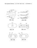 JOINT ARTHROPLASTY DEVICES AND SURGICAL TOOLS diagram and image