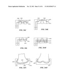 JOINT ARTHROPLASTY DEVICES AND SURGICAL TOOLS diagram and image