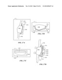 JOINT ARTHROPLASTY DEVICES AND SURGICAL TOOLS diagram and image