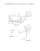 JOINT ARTHROPLASTY DEVICES AND SURGICAL TOOLS diagram and image