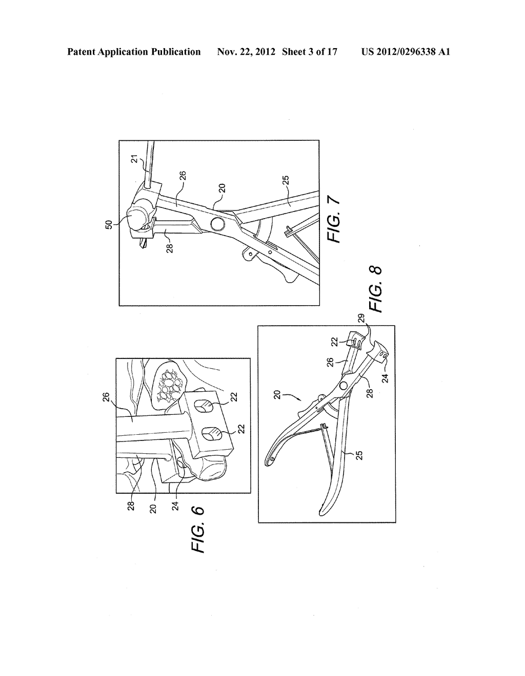 LATARJET INSTRUMENTATION AND METHOD - diagram, schematic, and image 04