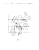 System and method for hyoidplasty diagram and image