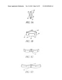 System and method for hyoidplasty diagram and image