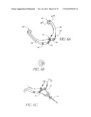 System and method for hyoidplasty diagram and image