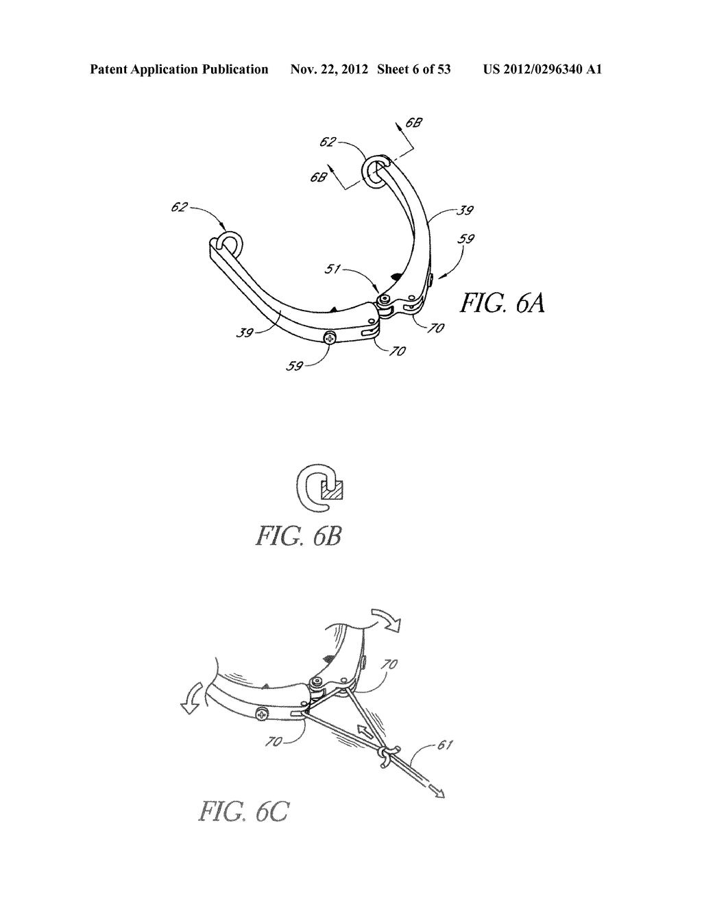System and method for hyoidplasty - diagram, schematic, and image 07