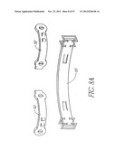 System and method for hyoidplasty diagram and image