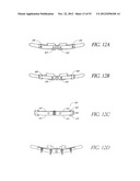 System and method for hyoidplasty diagram and image