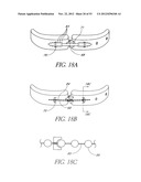 System and method for hyoidplasty diagram and image