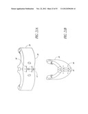 System and method for hyoidplasty diagram and image