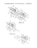 System and method for hyoidplasty diagram and image