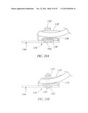 System and method for hyoidplasty diagram and image