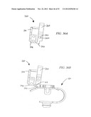 System and method for hyoidplasty diagram and image