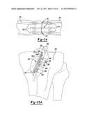 Tissue Engaging Member diagram and image