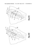 Tissue Engaging Member diagram and image