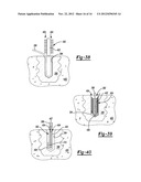 Tissue Engaging Member diagram and image