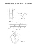 Clip Apparatus for Closing Septal Defects and Methods of Use diagram and image