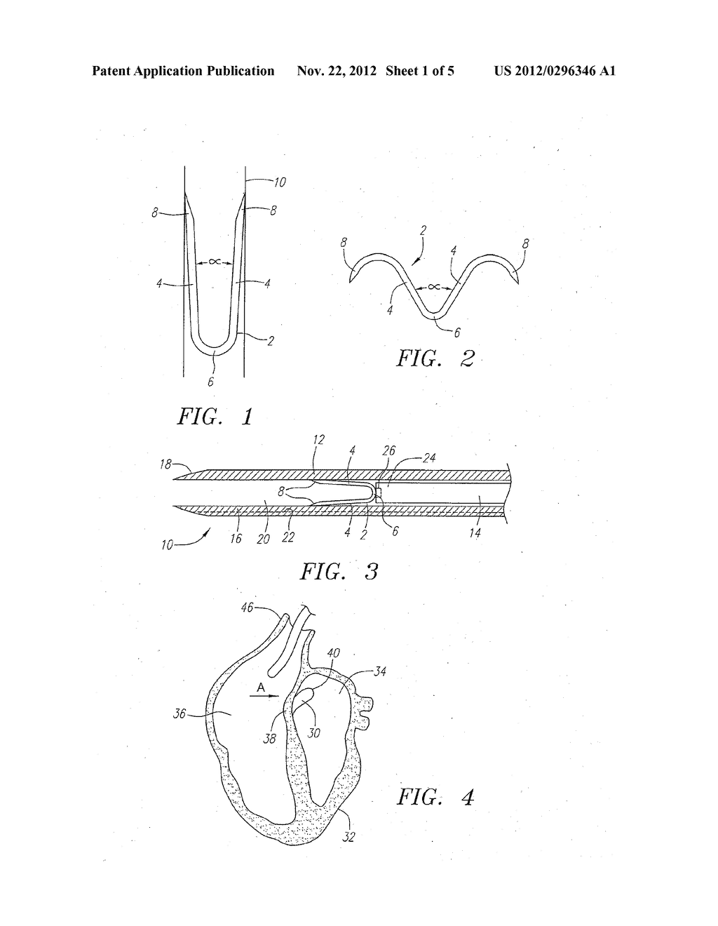 Clip Apparatus for Closing Septal Defects and Methods of Use - diagram, schematic, and image 02