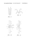 Clip Apparatus for Closing Septal Defects and Methods of Use diagram and image