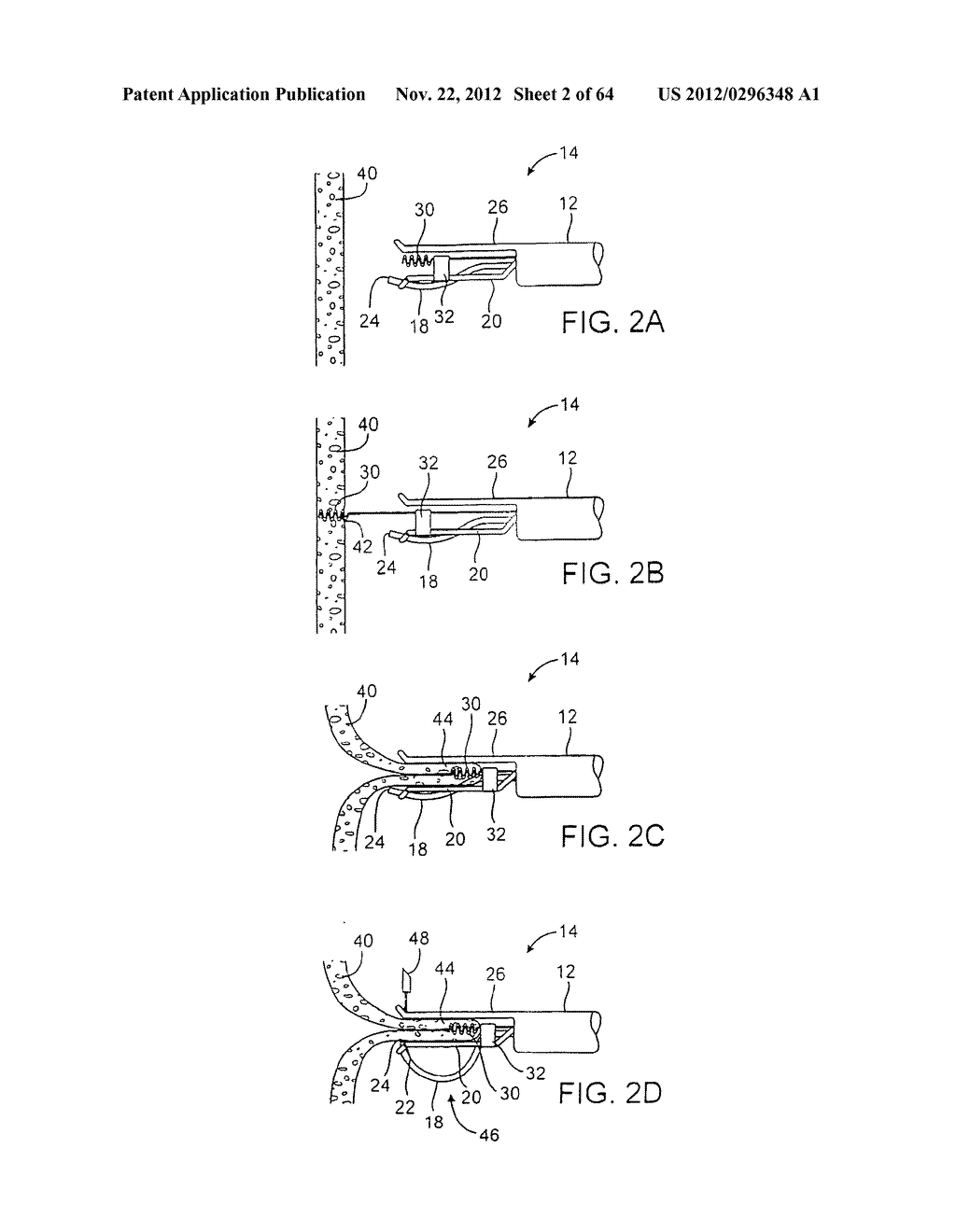 APPARATUS FOR MANIPULATING AND SECURING TISSUE - diagram, schematic, and image 03