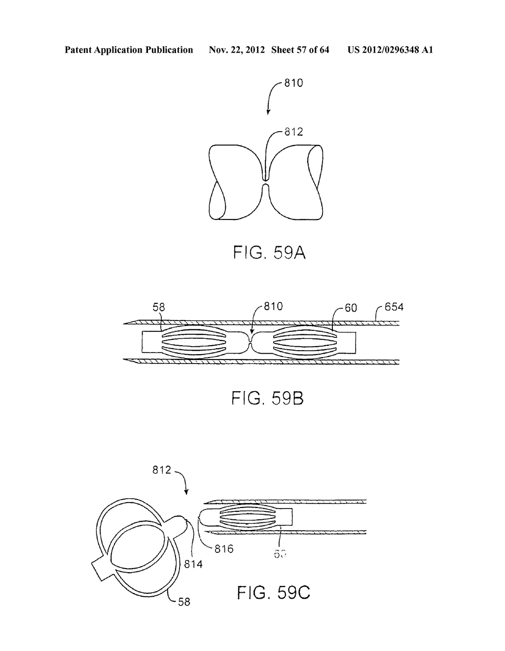 APPARATUS FOR MANIPULATING AND SECURING TISSUE - diagram, schematic, and image 58