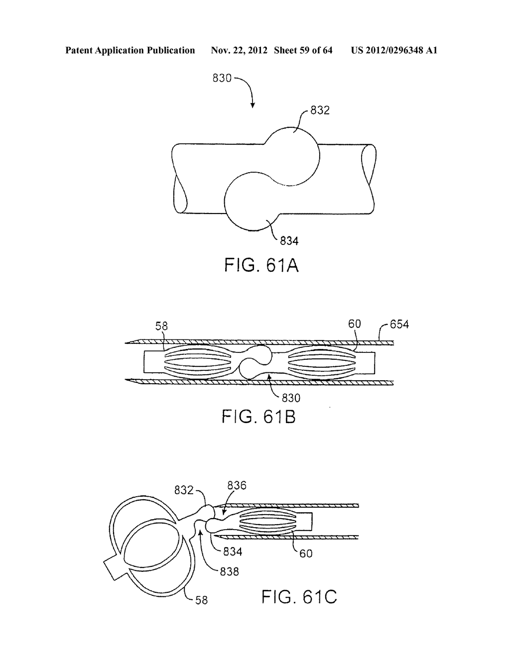 APPARATUS FOR MANIPULATING AND SECURING TISSUE - diagram, schematic, and image 60