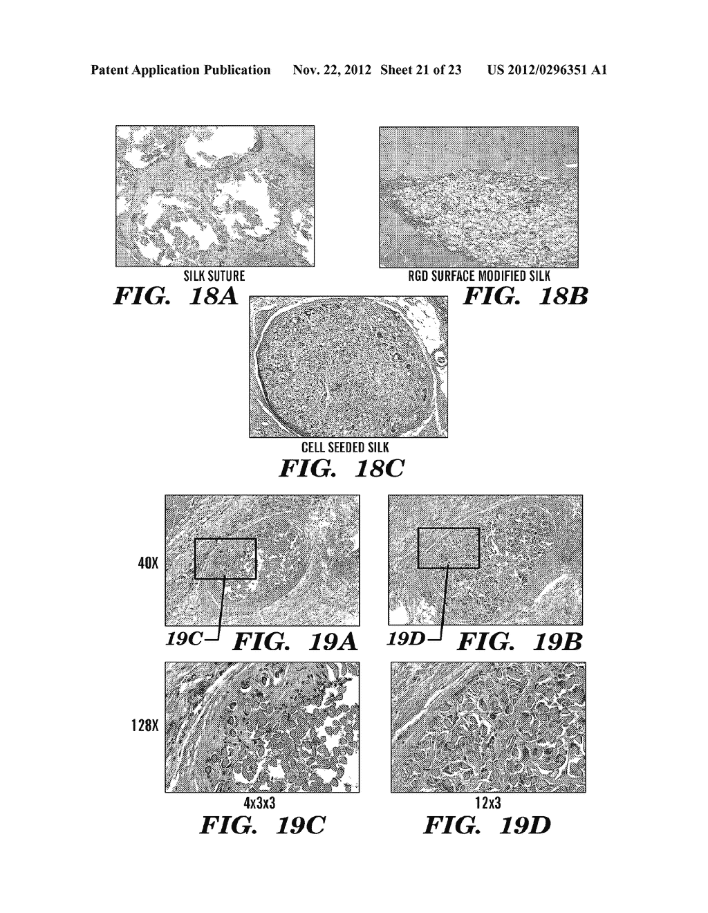 SERICIN EXTRACTED FABRICS - diagram, schematic, and image 22