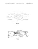 COMPRESSION UNIT AND A RADIAL ARTERY COMPRESSION SYSTEM diagram and image