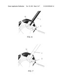 COMPRESSION UNIT AND A RADIAL ARTERY COMPRESSION SYSTEM diagram and image