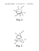 DIGITAL SUTURE FIXATION SYSTEM diagram and image